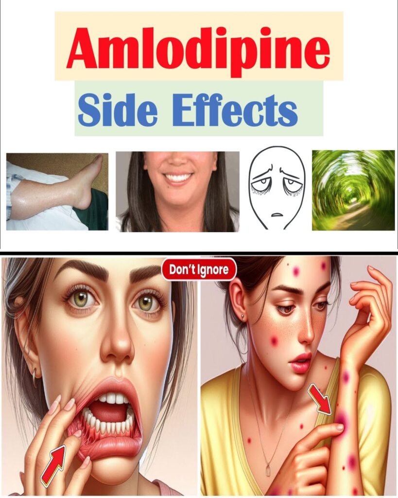 Amlodipine Side Effects: What They Mean and How You May Reduce Risk