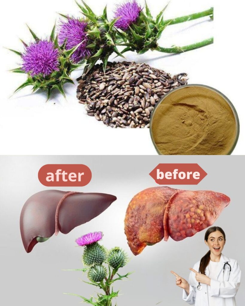 🌿 Milk Thistle: The Free “Wild Medicine” Growing Everywhere