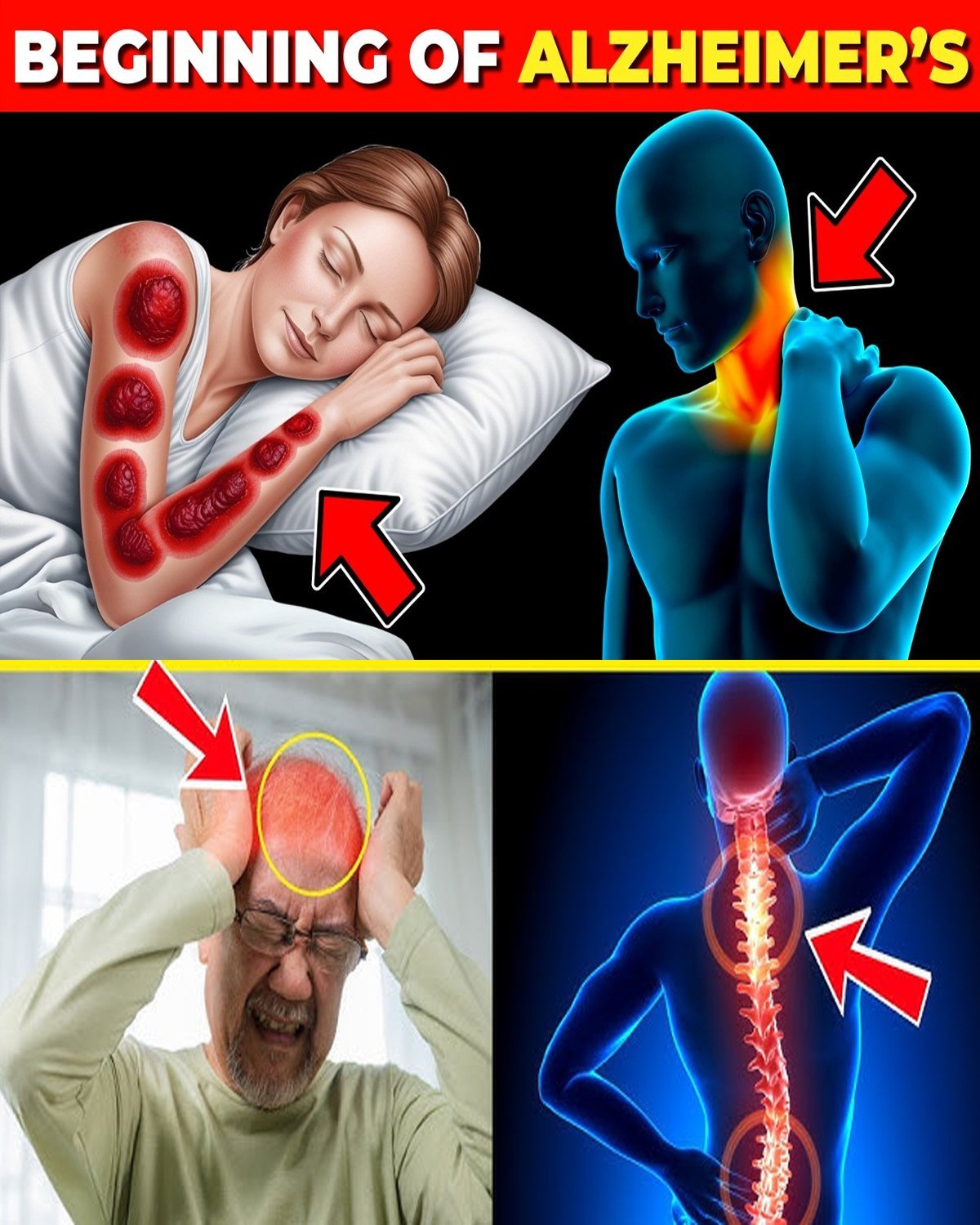 7 EARLY SIGNS of ALZHEIMER’S DISEASE that you SHOULD NEVER IGNORE!