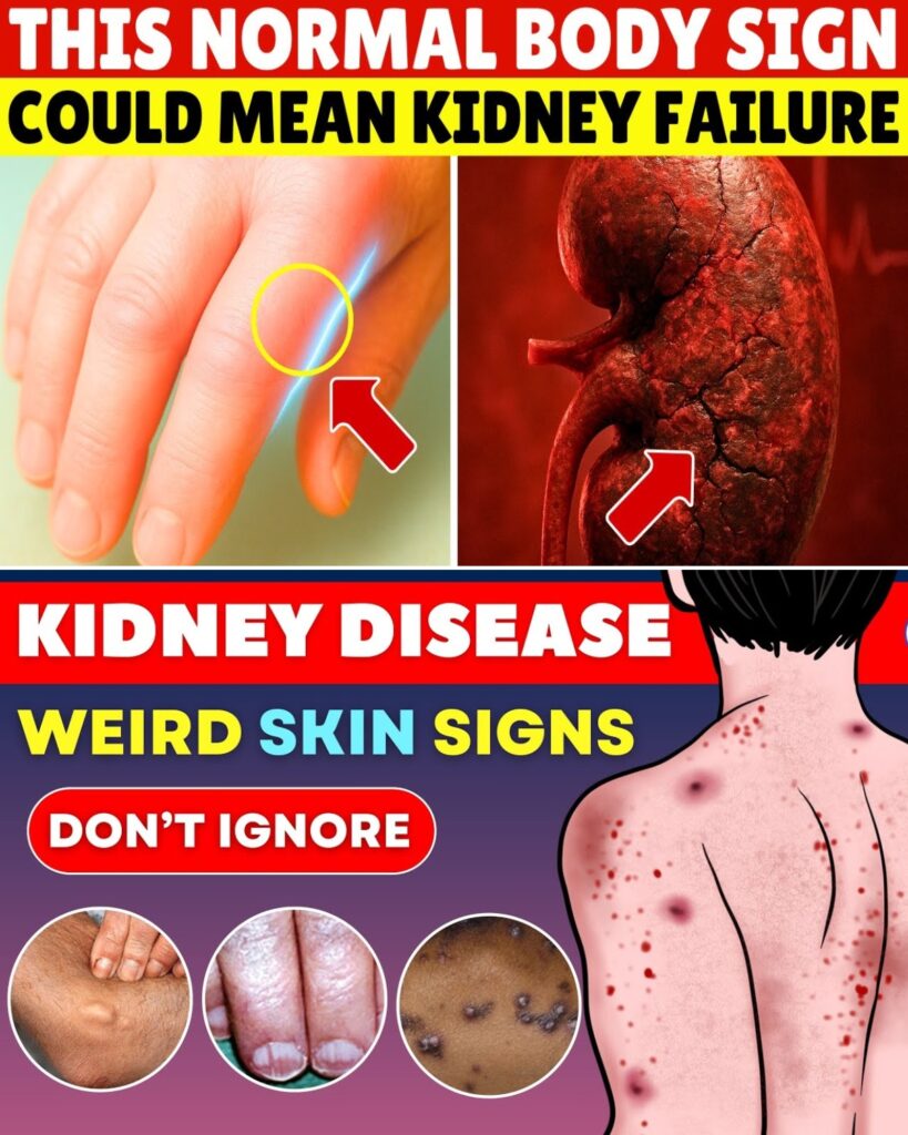 Foamy Urine: The Silent Kidney Disease Symptom 90% of People Ignore (Doctor Reveals 15 Warning Signs You’re Missing)