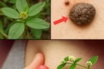 Remove warts fast with this natural leaf — no pain, no irritation!