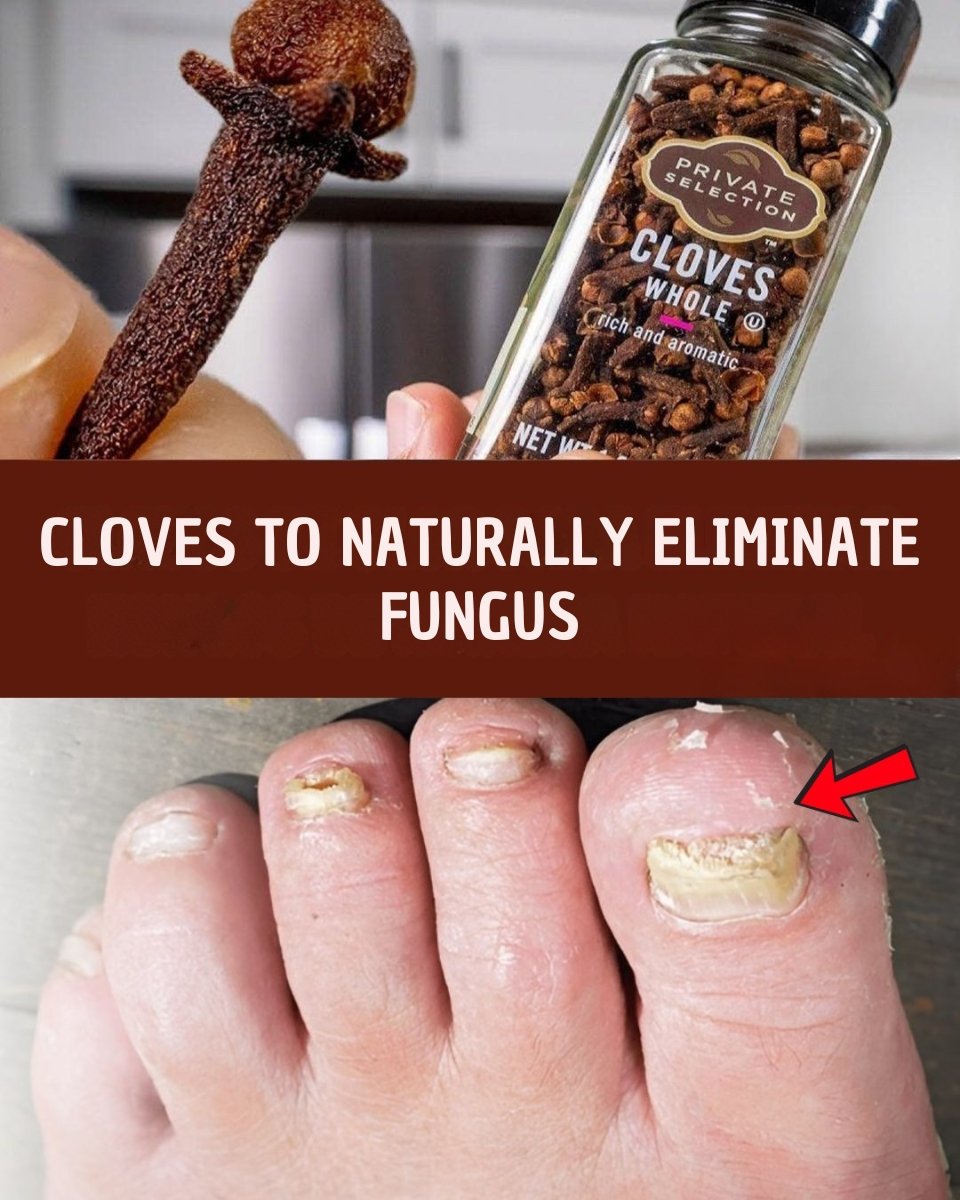 🌿 Cloves for Nail Fungus: A Gentle, Natural Way to Restore Healthy Nails