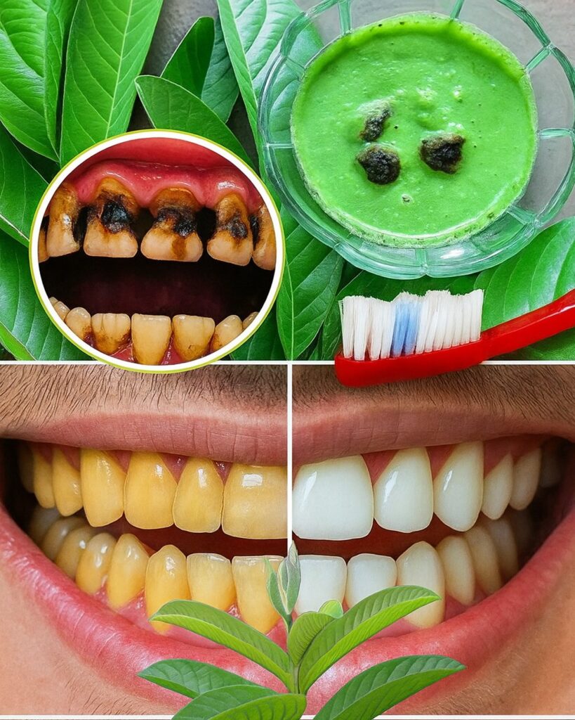 3 Surprising Ways Guava Leaves Can Help Fight Tooth Decay and Save Your Smile Naturally
