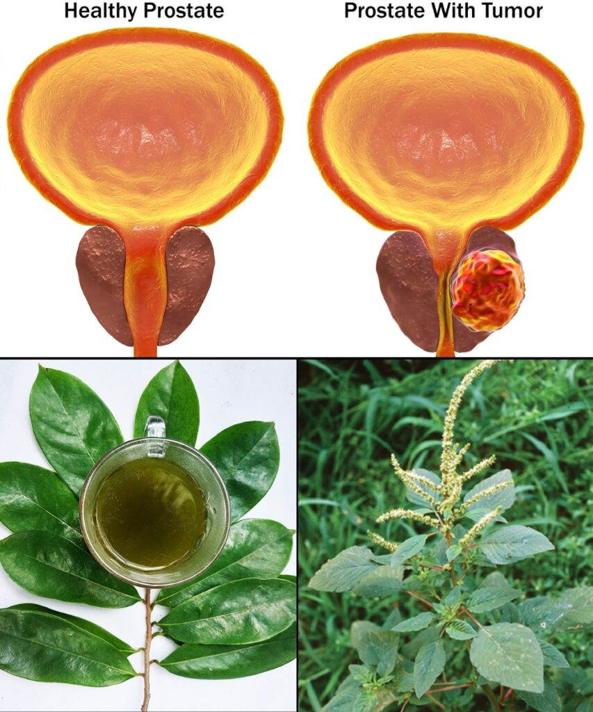 No Man Should Die From Prostate Cancer: A Powerful Natural Remedy Every Man Should Know