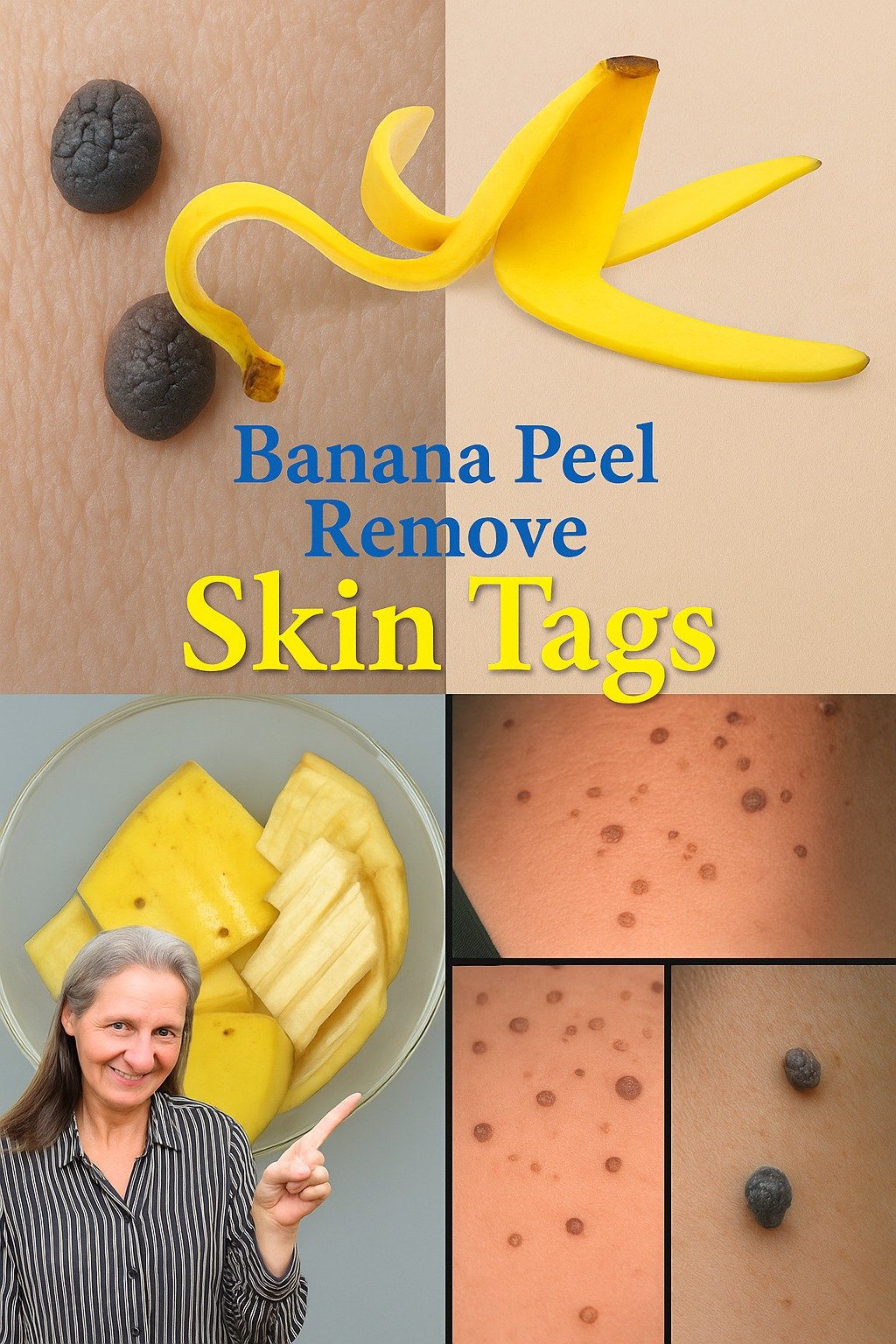🍌 How to Remove Skin Tags on Your Face Naturally — With Banana Peel and Other Gentle Remedies