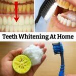 7 Powerful Home Remedies to Whiten Your Teeth Naturally (No Dentist Needed!)
