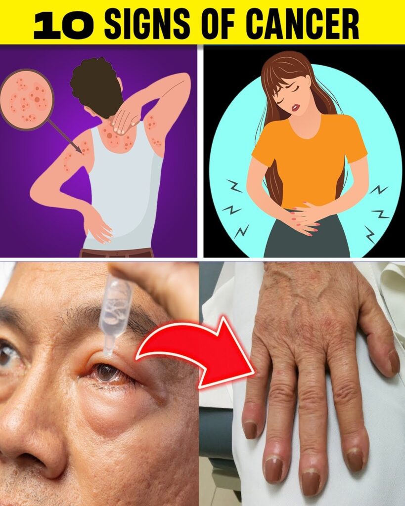 10 Cancer Signs that 90% of People Ignore