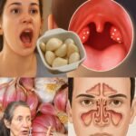 Why Garlic Might Be the Simple Kitchen Remedy You Need for Fewer UTIs and Better Urinary Health