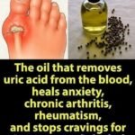 The oil renowned for eliminating uric acid from the bloodstream, alleviating anxiety, chronic arthritis, rheumatism, and reducing cravings for cigarettes and alcohol.