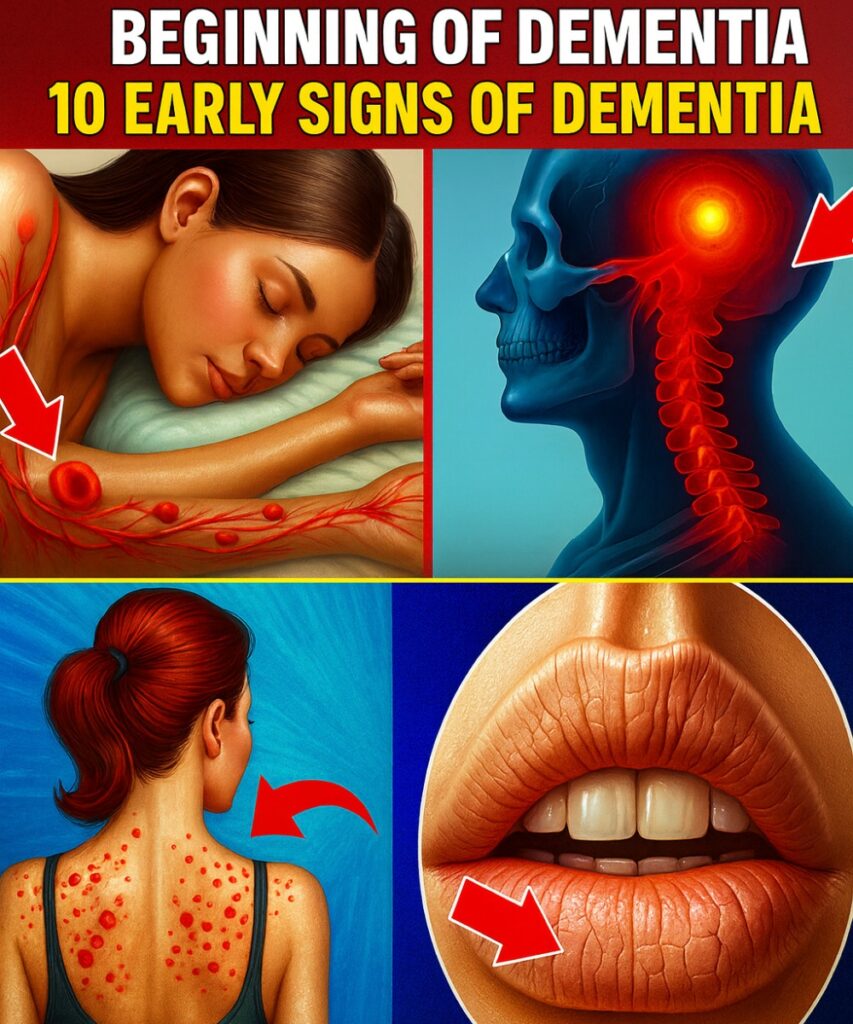 10 Early Signs of Dementia You Should Never Ignore (They Start Sooner Than You Think)