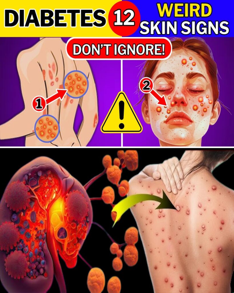 10 Weird Skin Signs of Diabetes You Should Never Ignore