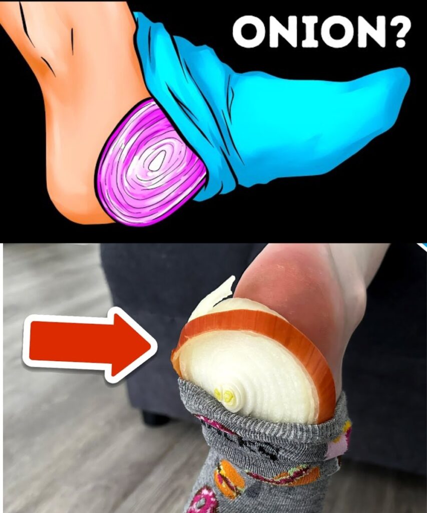 The Surprising Benefits of Placing an Onion in a Sock