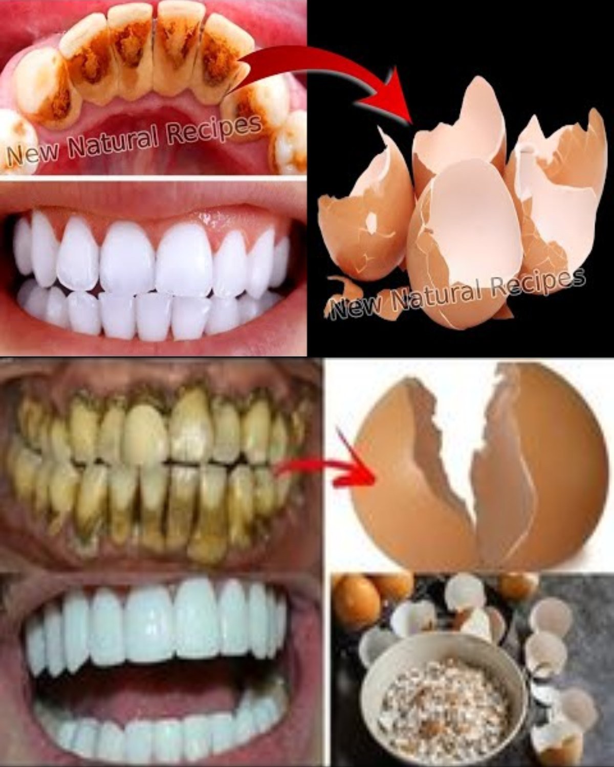 Eggshell Powder and Toothpaste: Unlock Tartar-Free Teeth Naturally at Home