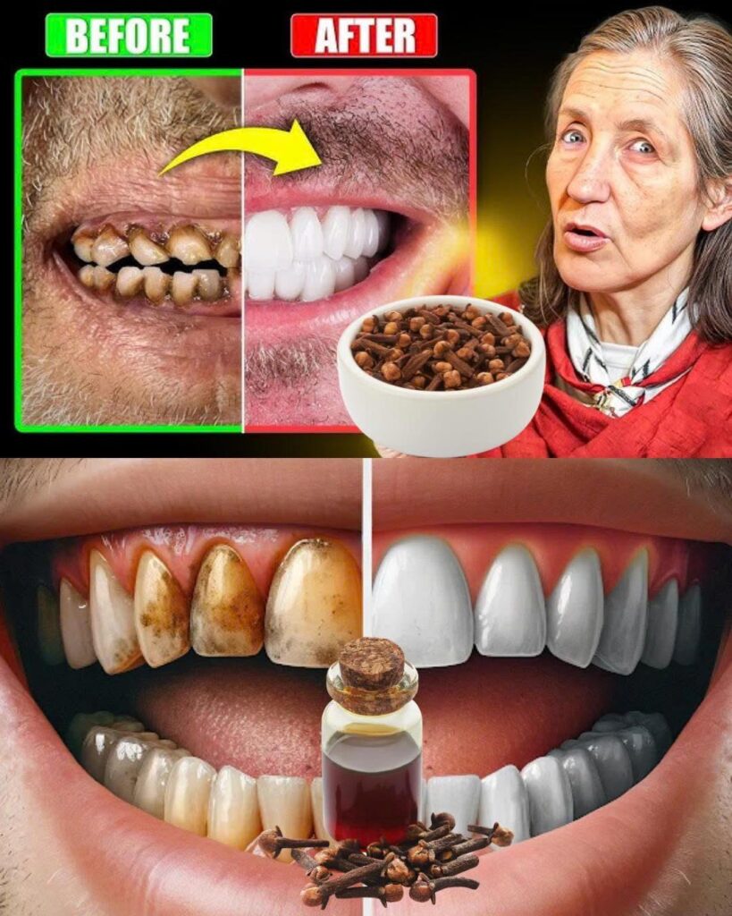 🥥 Barbara O’Neil Reveals the Secret to Reversing Cavities in Just 24 Hours with This Simple Oil Trick!