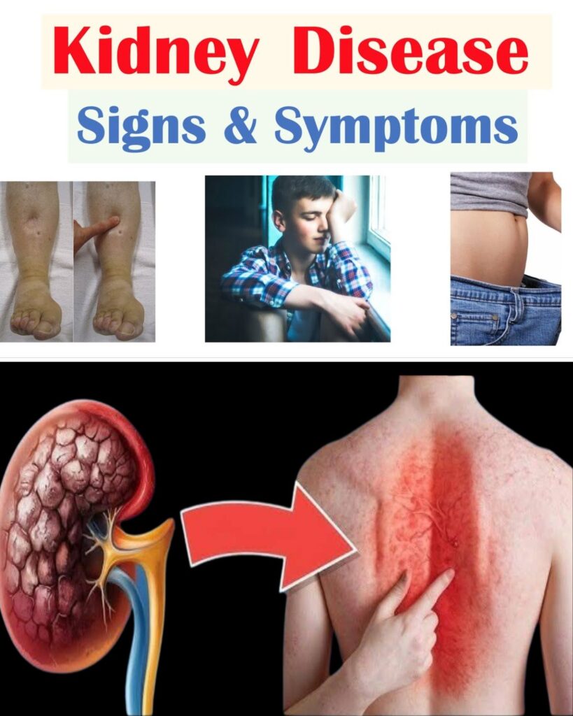 Silent Signs of Kidney Disease You Shouldn’t Ignore