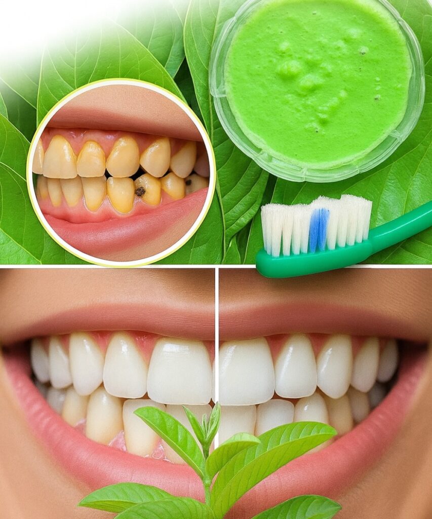 The Tropical Toothpaste Secret: Could This Humble Leaf Erase Tooth Decay and Banishing Gum Pain?