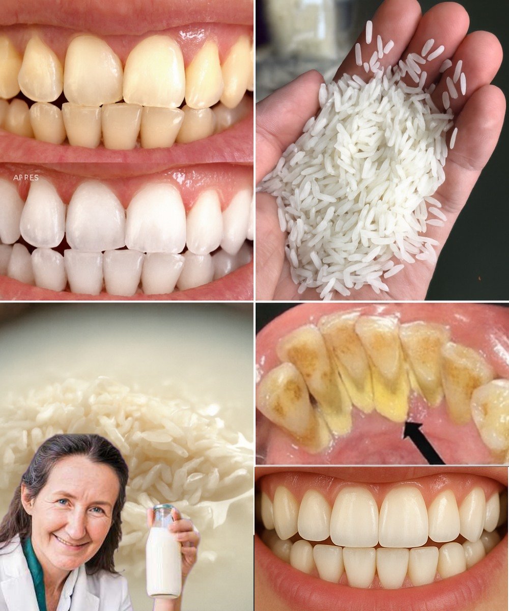 Say Goodbye to Tartar and Hello to a Brighter Smile with Rice Water