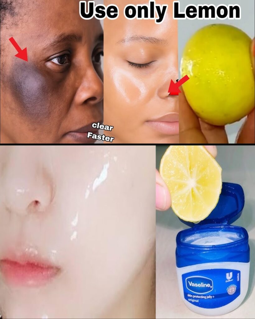 Lemon Face Cleanser Magic: Brighten Skin & Erase Dark Spots in Minutes