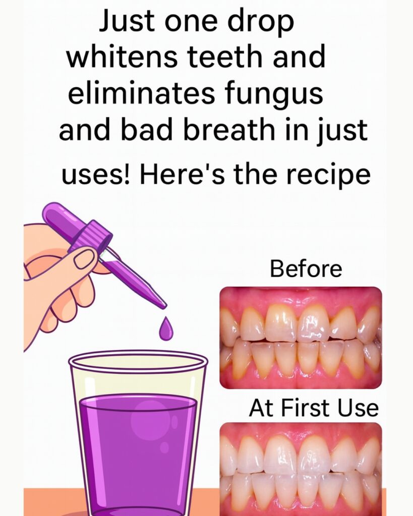 Remove tartar from your teeth and whiten them with this simple recipe