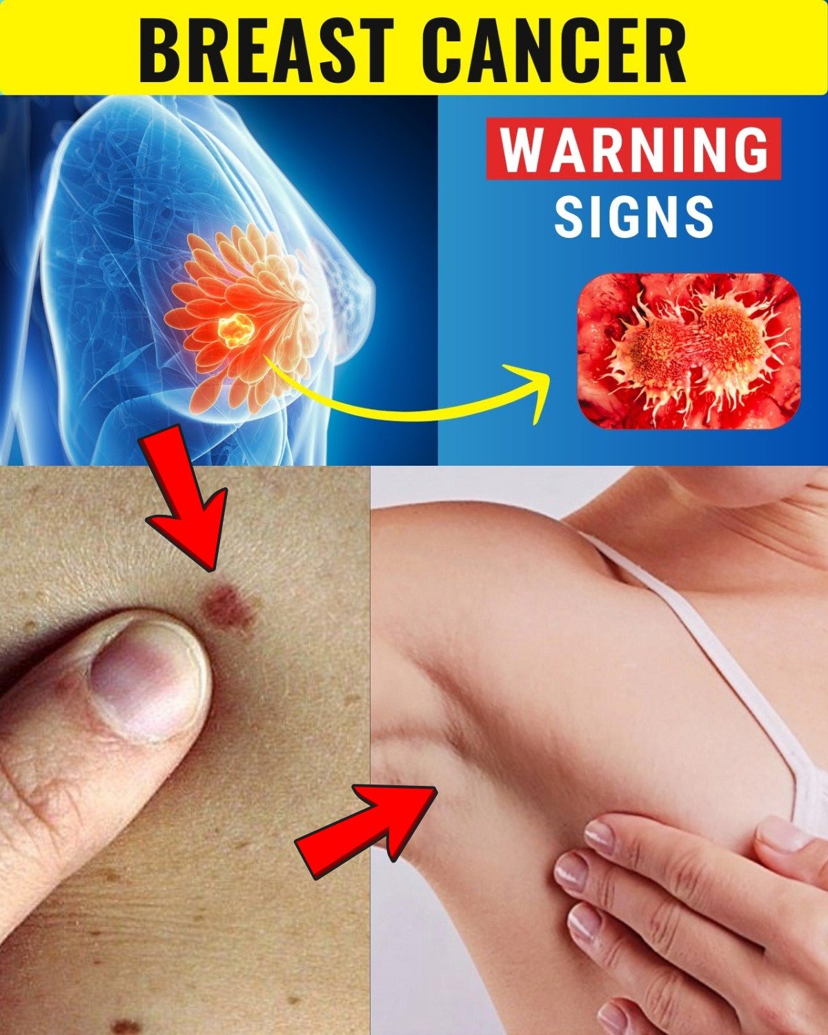 10 Warning Signs of Breast Cancer You MUST Know – Early Detection Saves Lives