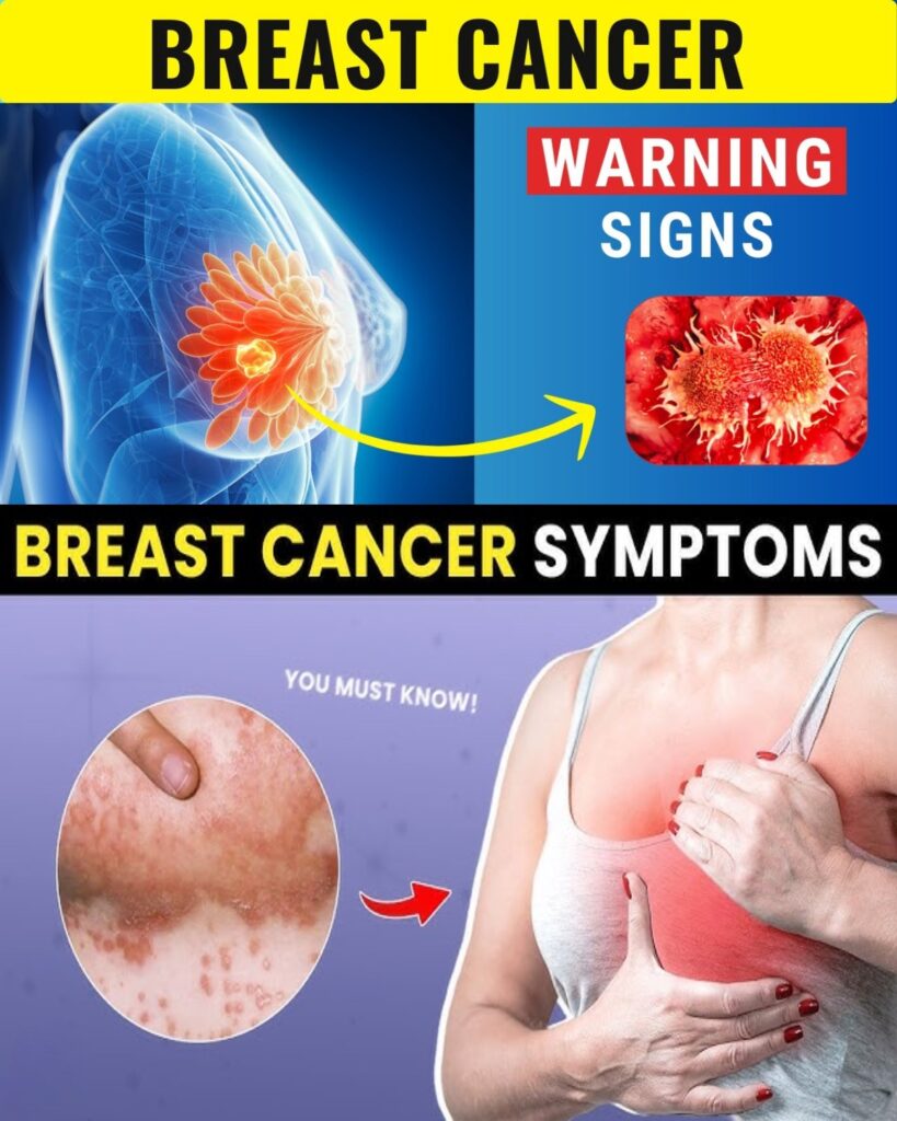 10 Warning Signs of Breast Cancer You MUST Know – Early Detection Saves Lives