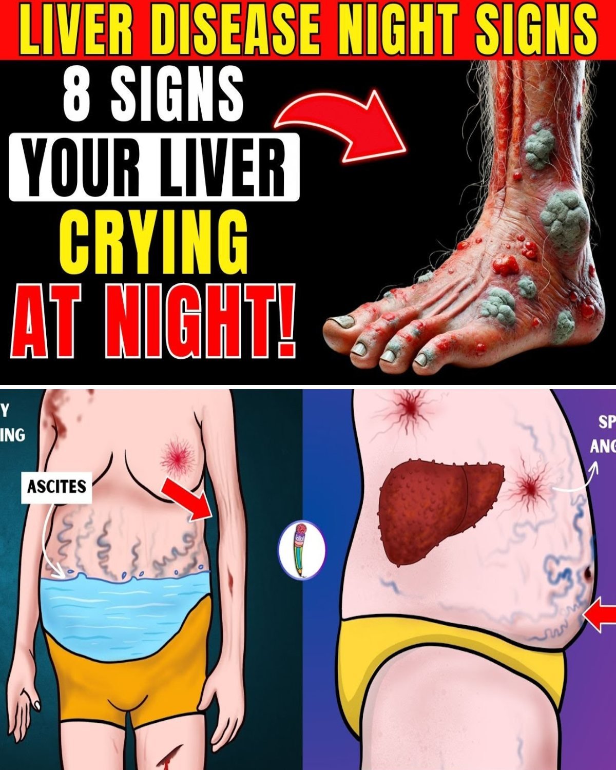8 Nighttime Signs Your Liver May Be Struggling and How to Stay Ahead