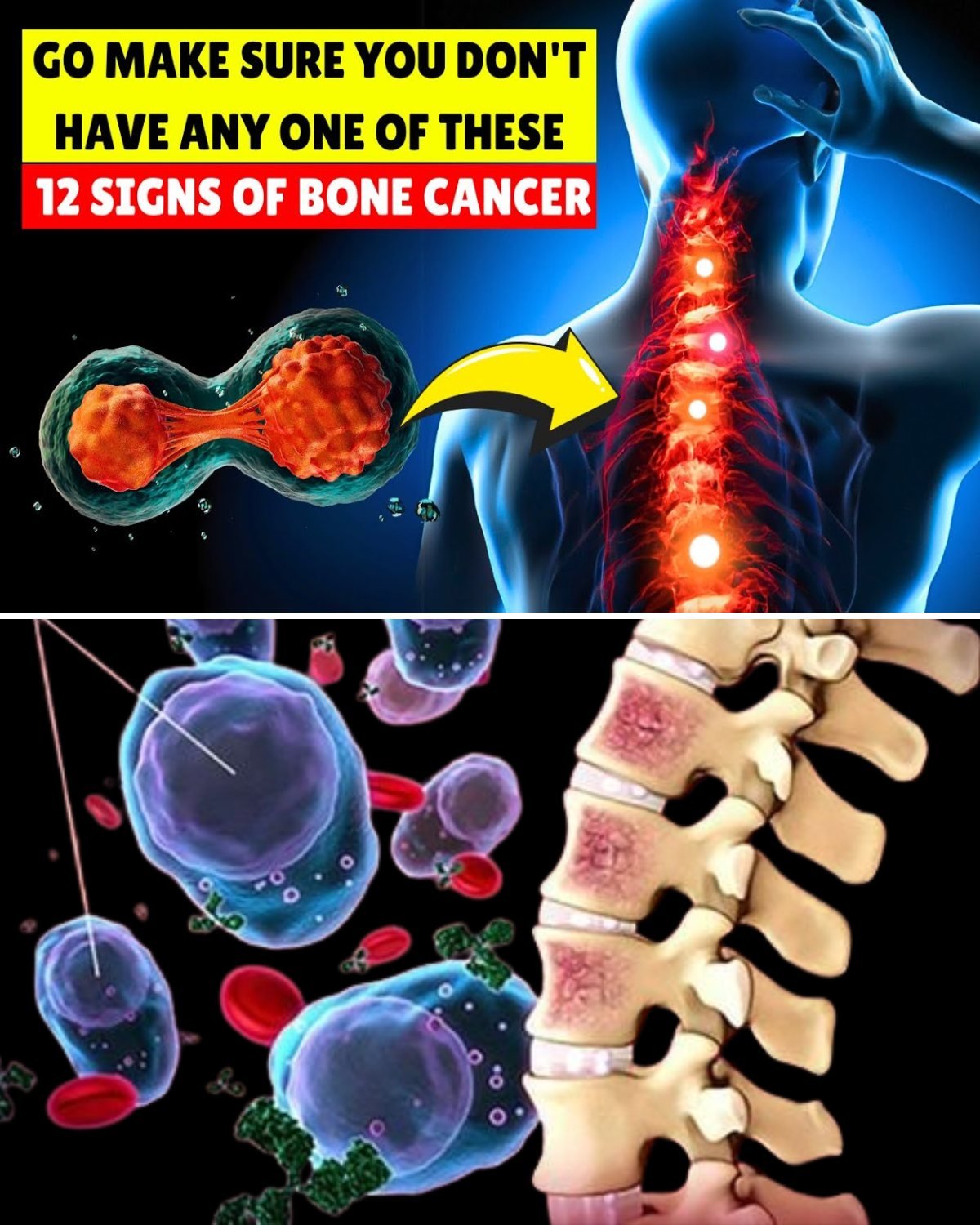 10 Warning Signs of Bone Cancer You Can’t Afford to Ignore (Even Doctors Sometimes Miss #3)