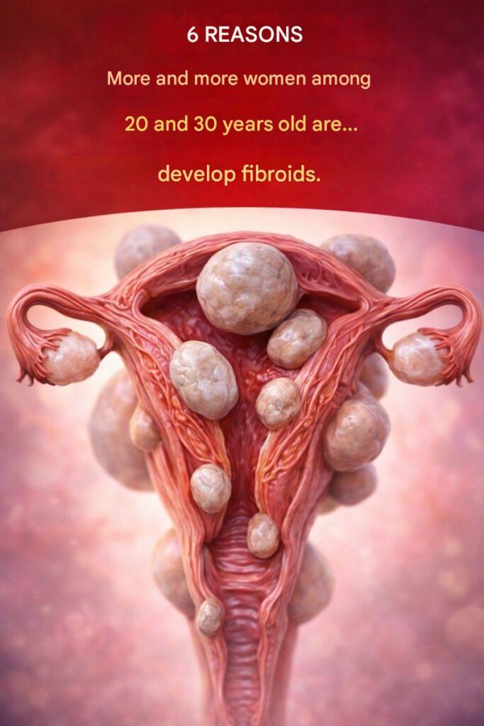 😱 6 Reasons More Women in Their 20s and 30s Are Developing Fibroids