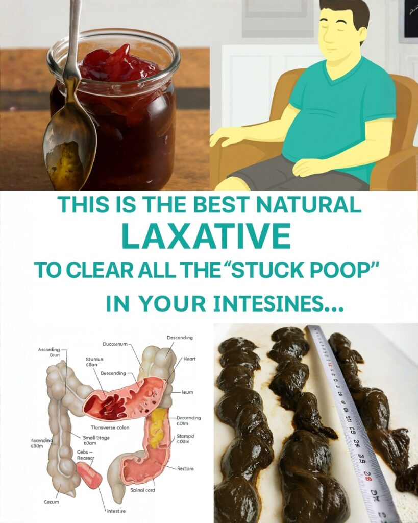 The Best Natural Laxative to Clear Out “Stuck Poop” and Reset Your Gut Naturally
