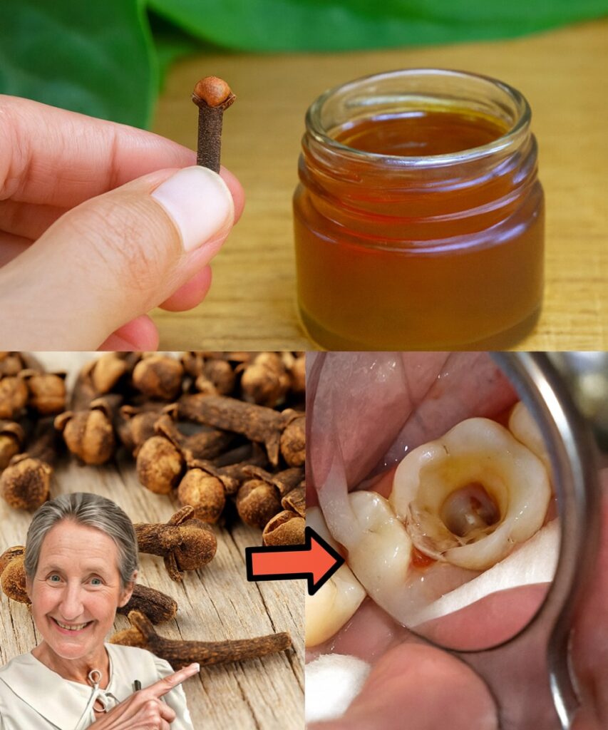 The $3 Spice Jar in Your Kitchen That Turns Into Powerful Clove Oil (and the 8 Benefits You’ll Wish You Knew Sooner)