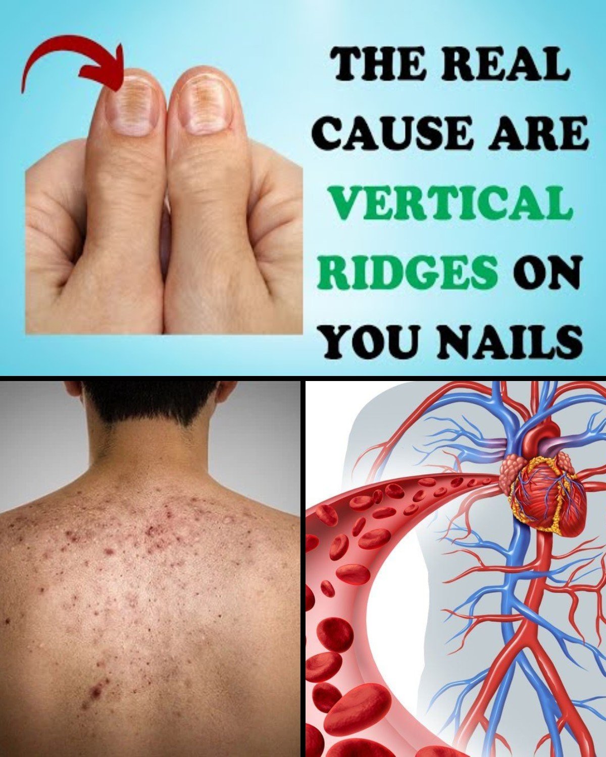 6 Surprising Causes of Vertical Lines on Your Nails—And What They Might Mean for Your Health