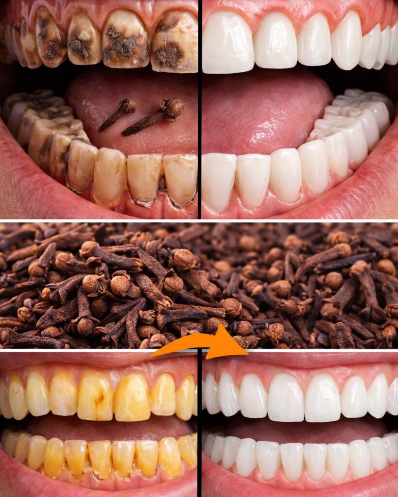 Chewing Cloves Daily: The 30-Second Trick That’s Saving Teeth, Stopping Gum Bleeding, and Turning “High-Risk” Dental Visits into “See You in a Year”