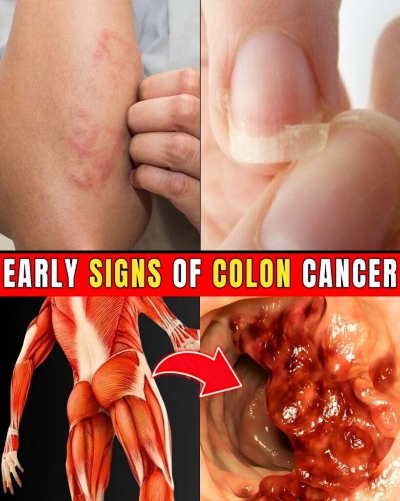 11 Silent Symptoms of Colon Cancer You Might Be Ignoring (And Why Early Detection Matters)