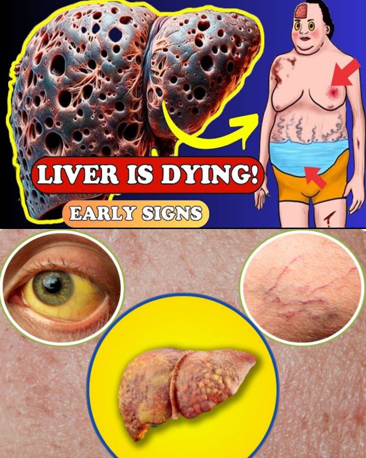 Your Liver Is Dying Quietly: 12 Strange Signs of Liver Damage You Must Know