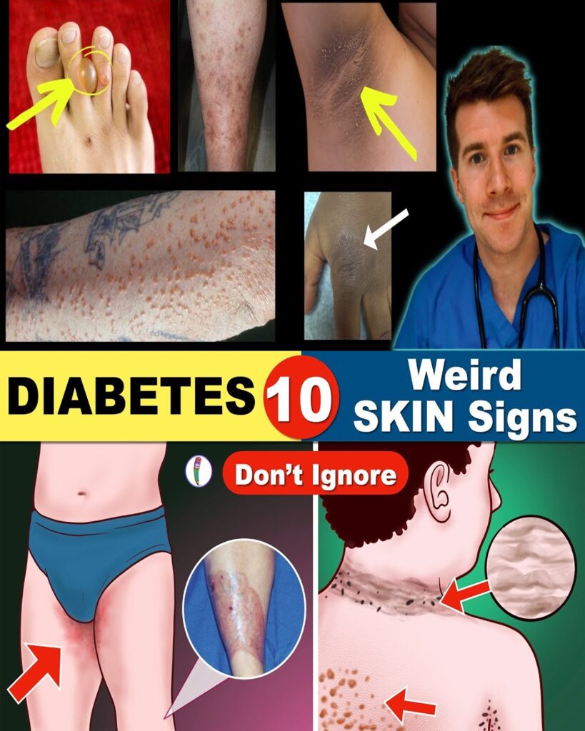 20 Subtle Signs You Might Have Diabetes Without Realizing It (And Why Early Awareness Matters)