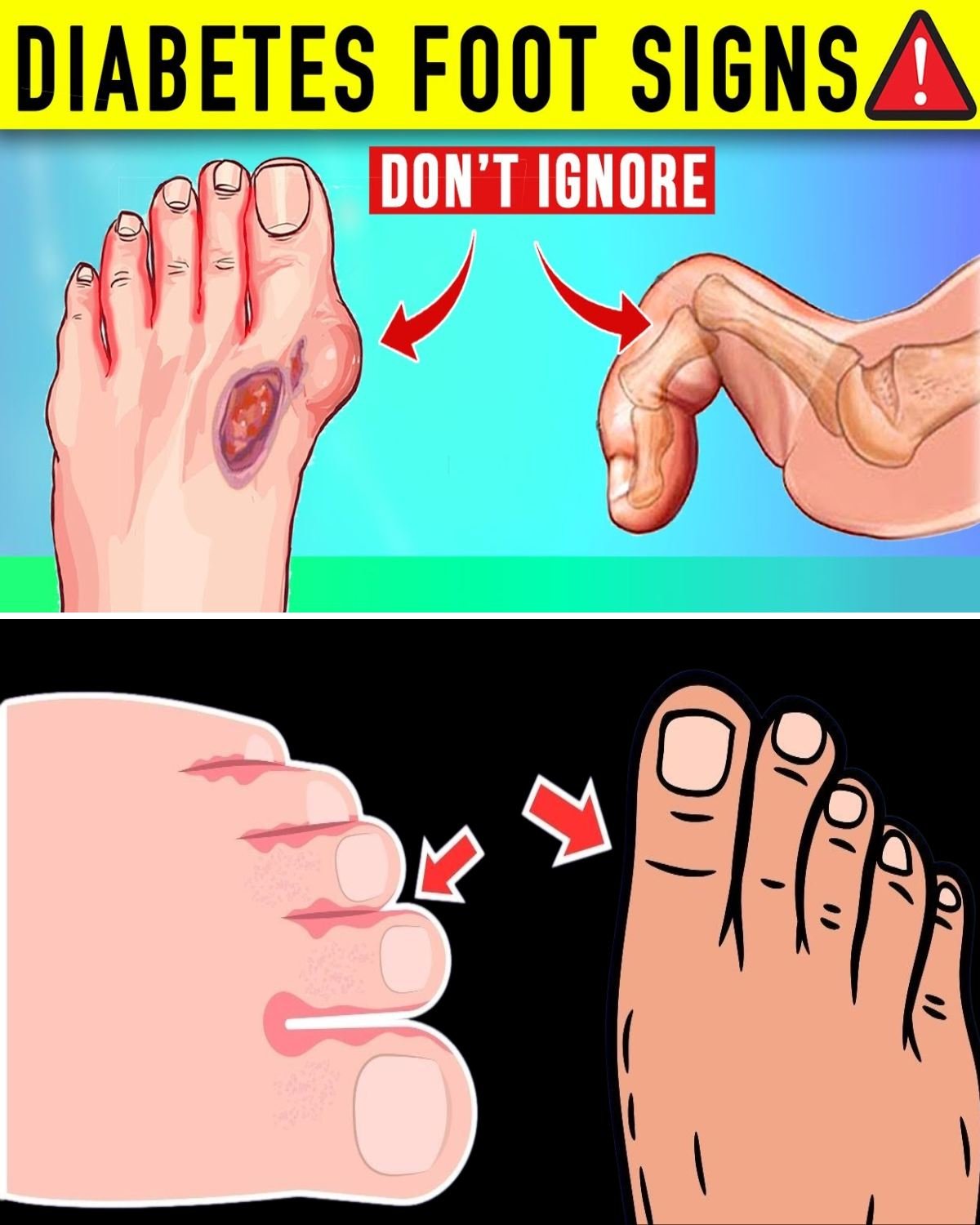 10 Must-Know Signs Your Feet Reveal About Diabetes