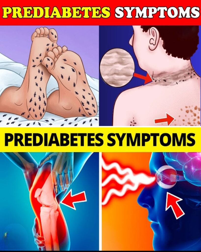 Don’t Ignore These: 12 Prediabetes Warning Signs and What Can Help