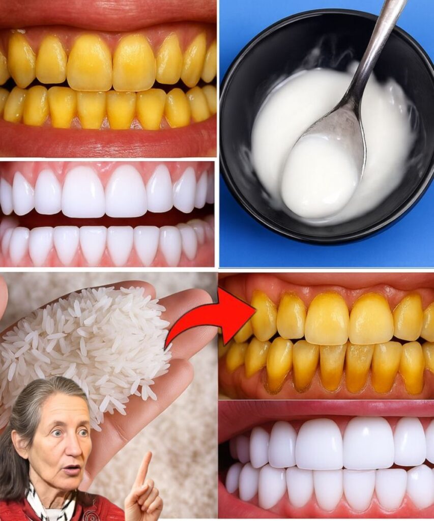 A Hidden At-Home Trick Dentists Wish More People Knew: Brighter Teeth and Less Buildup in Just 1 Minute
