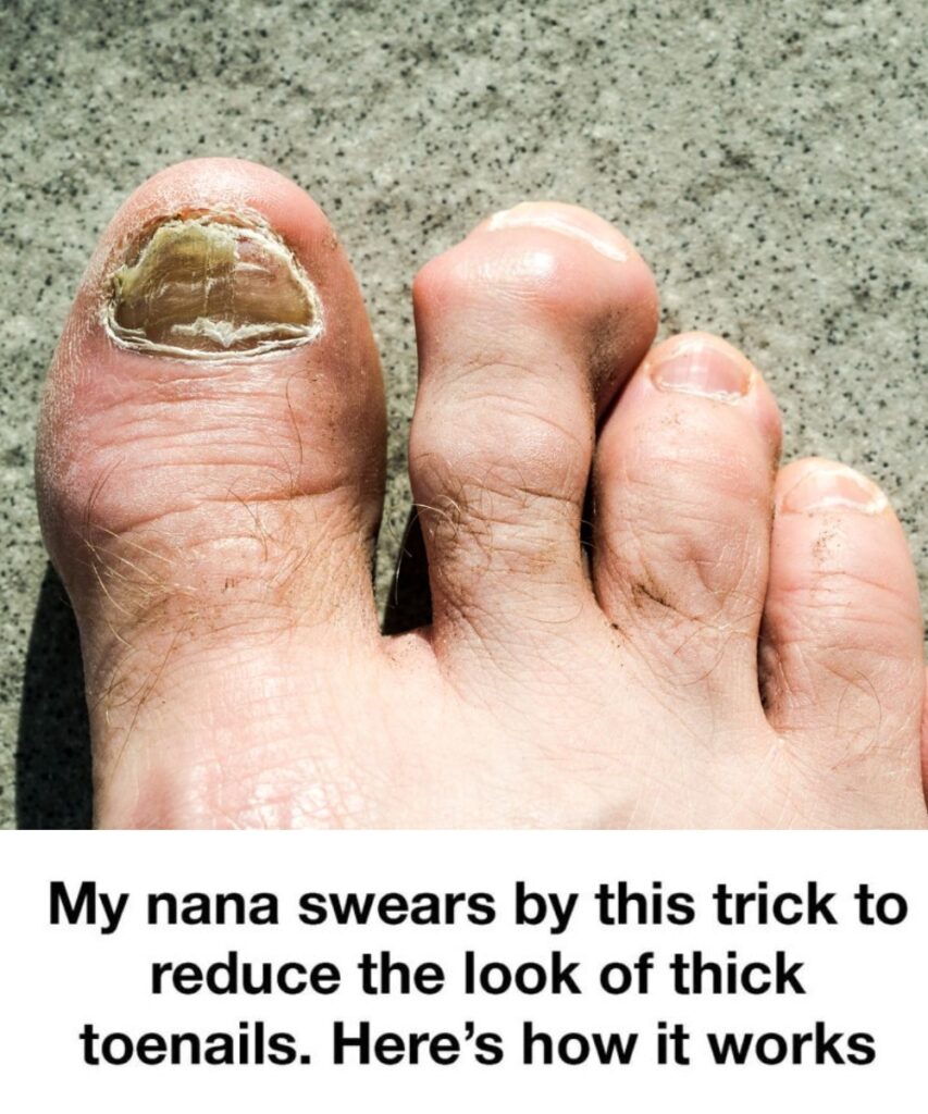 My Nana’s Simple Trick for Thick Toenails—And Why It Actually Works