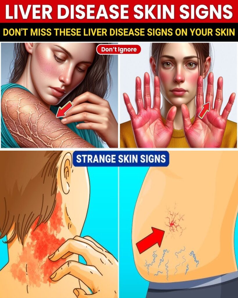Catch Liver Disease Early: 10 Skin Warnings You Shouldn’t Ignore