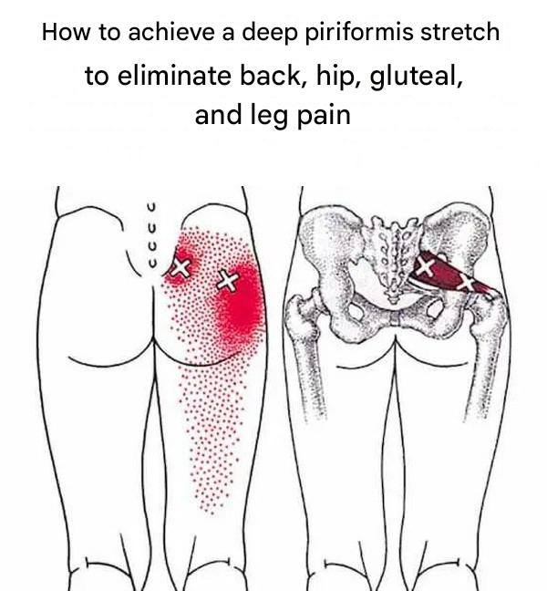 How to achieve a deep piriformis stretch to eliminate back, hip, gluteal, and leg pain