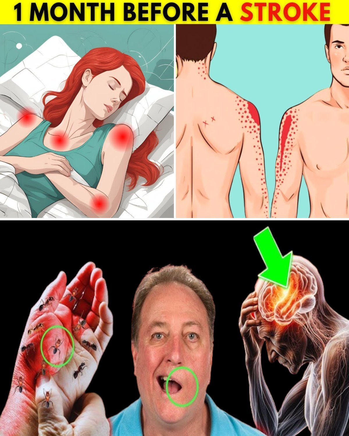 9 Early Signs of Stroke Appearing a Week Before: What Seniors Must Notice