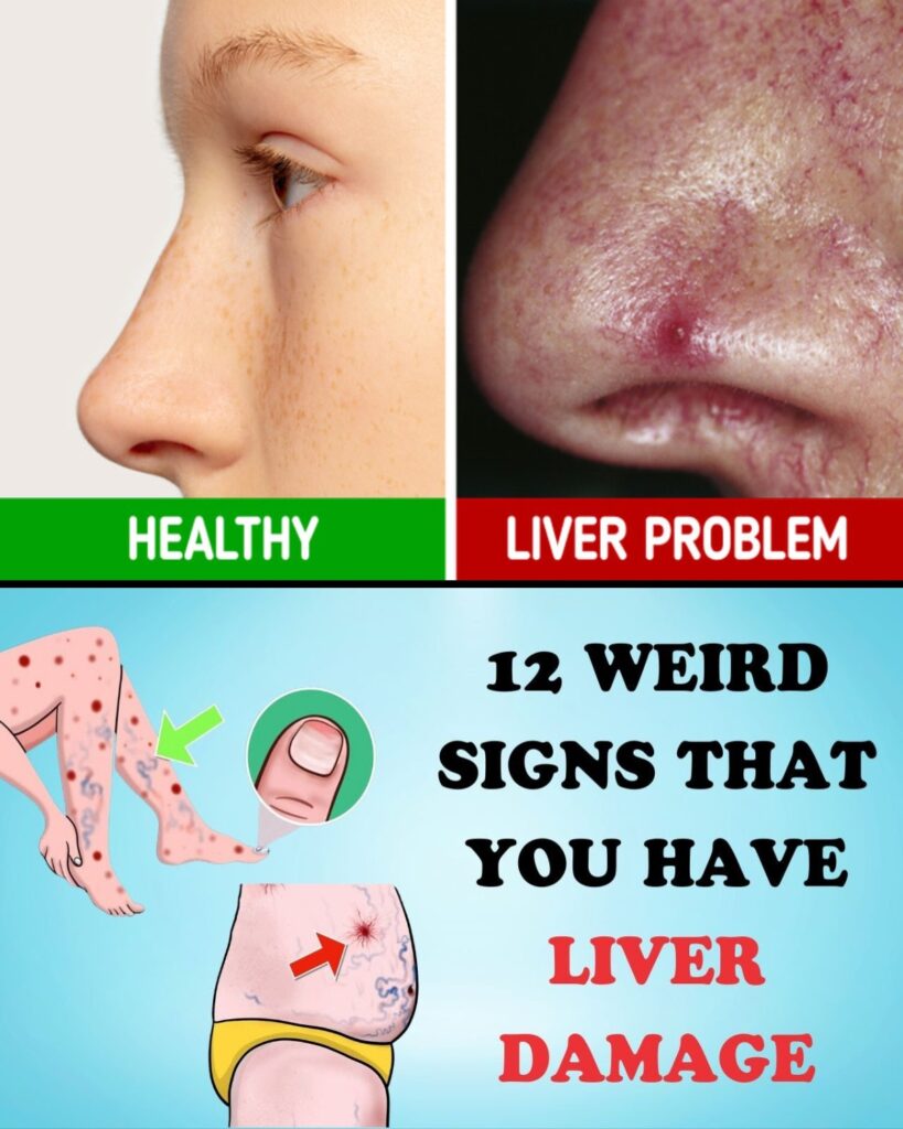 12 Unusual Warning Signs Your Liver Might Be Struggling (And Why You Shouldn’t Ignore Them)