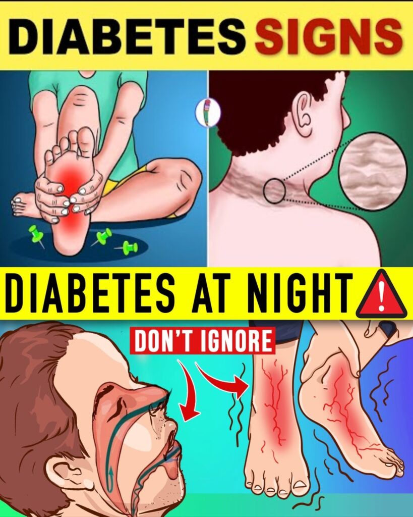 7 Dangerous Nighttime Signs of Diabetes You Can’t Ignore (And Why They Matter)