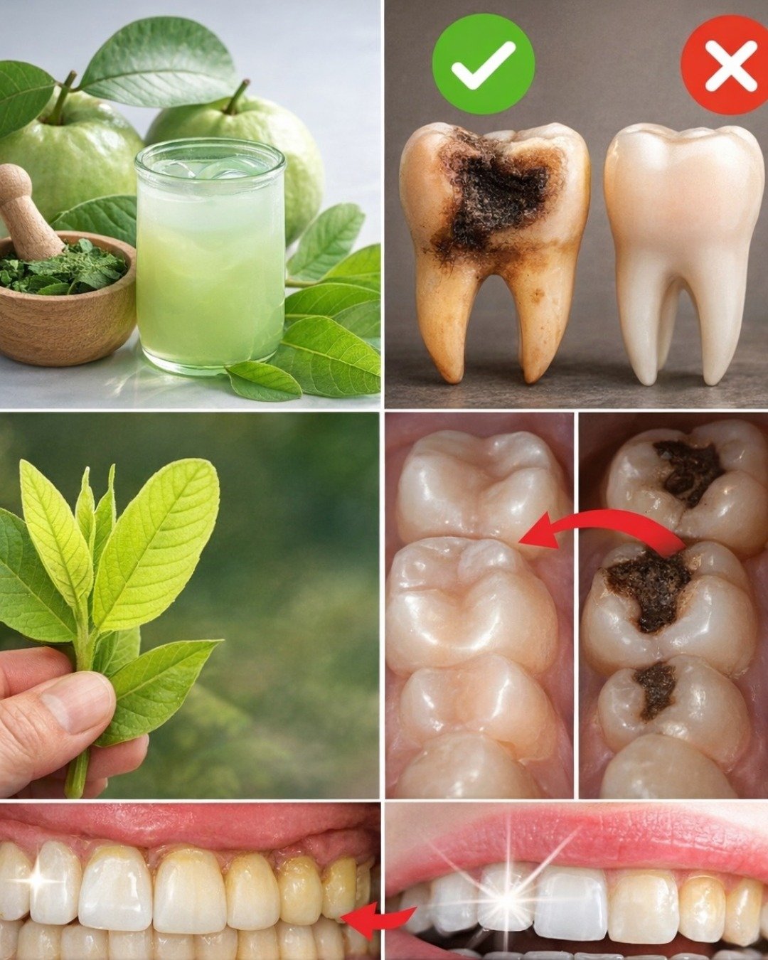🦷 3 Best Ways to Treat Tooth Decay with Guava Leaves – Simple and Affordable
