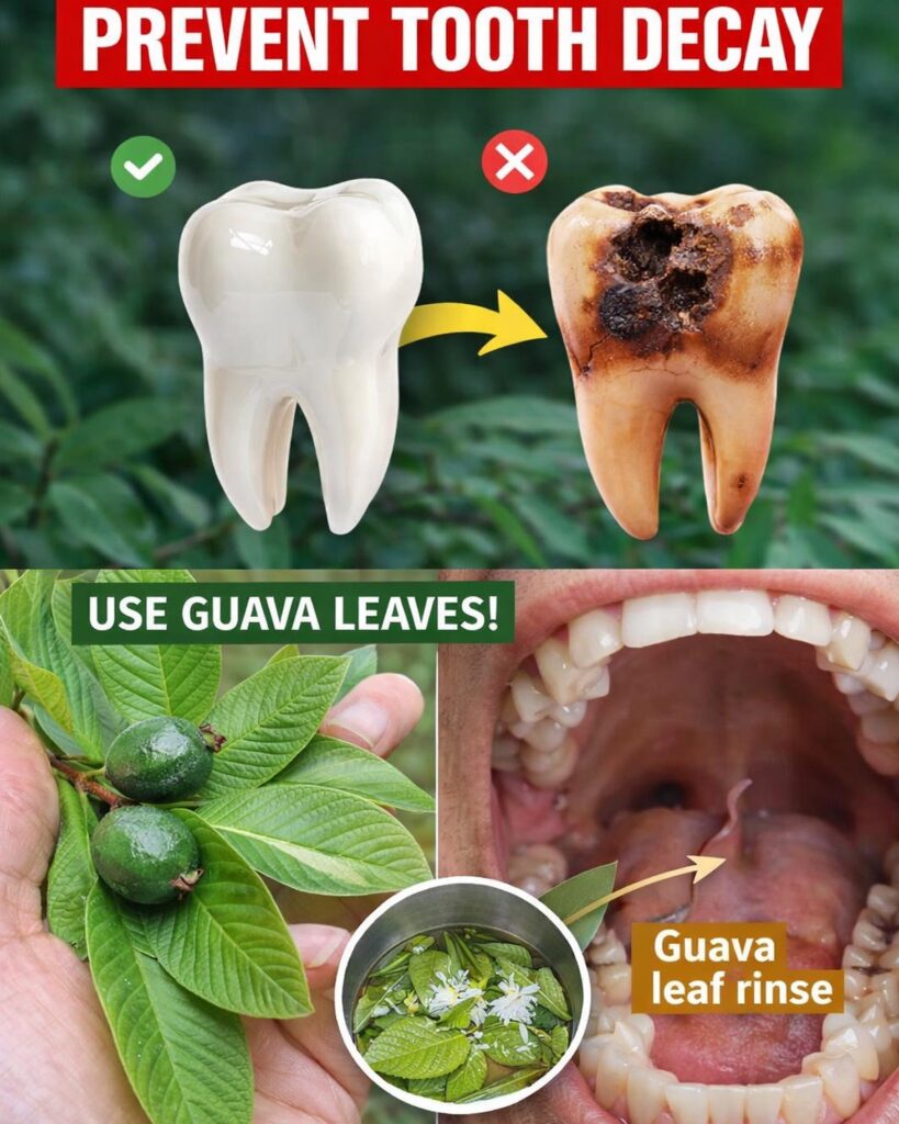 Top 3 Ways to Treat Tooth Decay with Guava Leaves – Simple and Cost-Effective