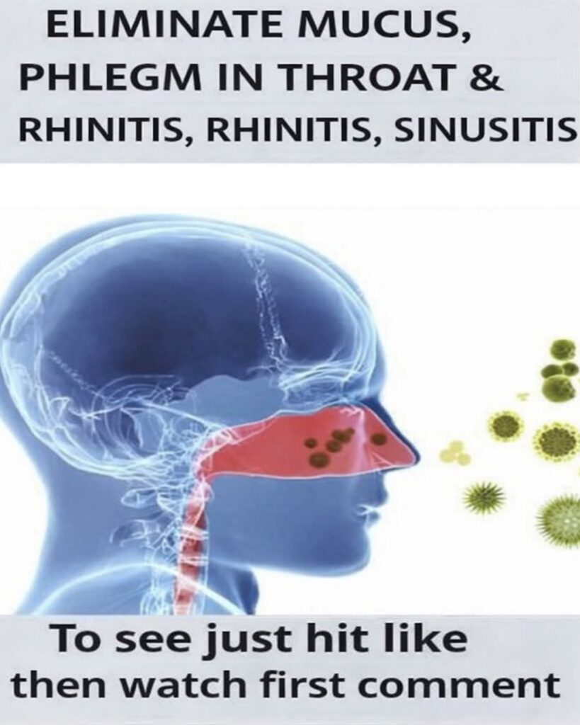 Eliminate Mucus and Phlegm Naturally: Clear Your Throat, Nose, and Say Goodbye to Rhinitis