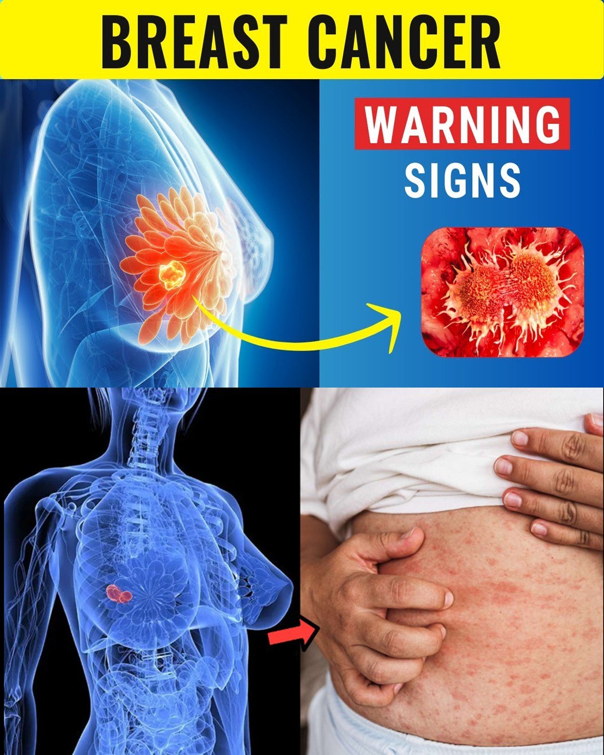 10 Warning Signs of Breast Cancer Most Women Ignore Until It’s Almost Too Late (The Ones That Save Lives When Caught Early)