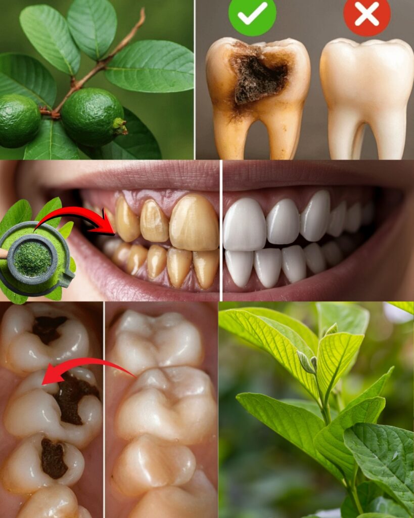 🌿 Discover Nature’s Secret: 3 Gentle Guava Leaf Remedies to Support Dental Health Naturally