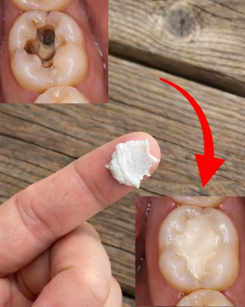 5 Simple Natural Home Remedies to Help Prevent Cavities and Support Healthy Teeth